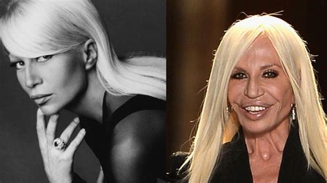 donatella versace without plastic surgery